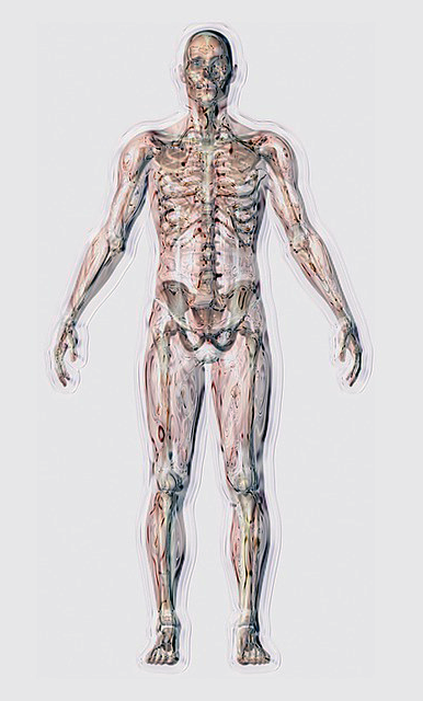 transparent body